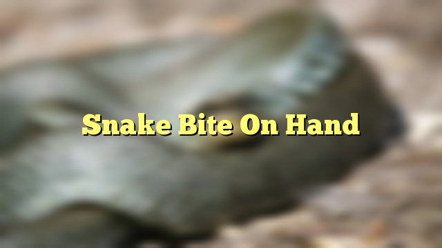 Snake Bite On Hand
