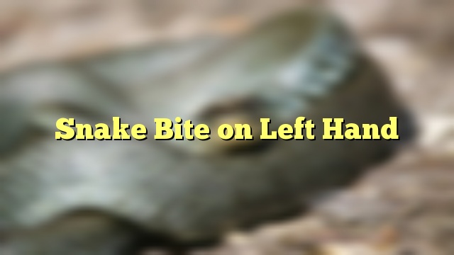 Snake Bite on Left Hand