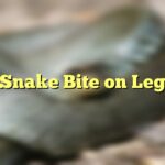 Snake Bite on Leg