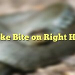 Snake Bite on Right Hand